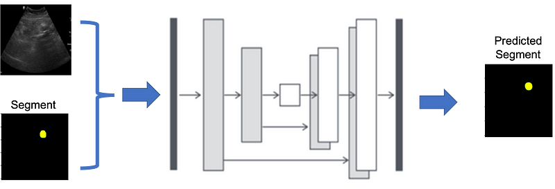 A Comprehensive Guide to UNet Implementation with TensorFlow