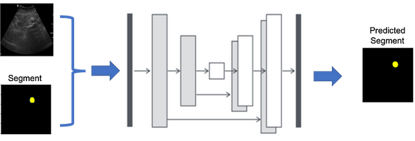 A Comprehensive Guide to UNet Implementation with TensorFlow